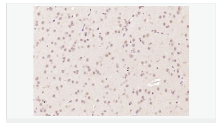 606579a61b2ab.png image.png