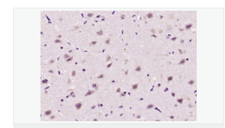 606bca12a584e.png image.png